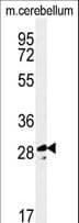 TESC Antibody (aa88-116)