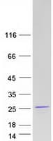 Human RNF181 Protein (Recombinant Myc-DDK (Flag))