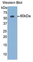 ALDH7A1 Antibody (aa1-539, PE)