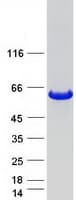 Human ALDH8A1 Protein (Recombinant Myc-DDK (Flag))