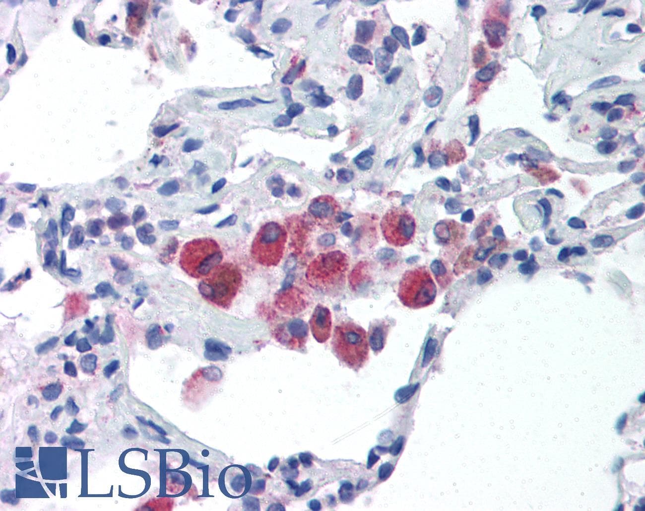 IHC-plus™ Polyclonal Rabbit anti-Human TLR5 Antibody (IHC, IF, WB)
