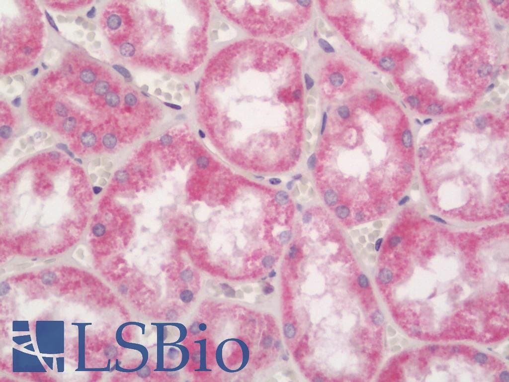 IHC-plus™ NFKBID / IkappaBNS Antibody (aa91-119)