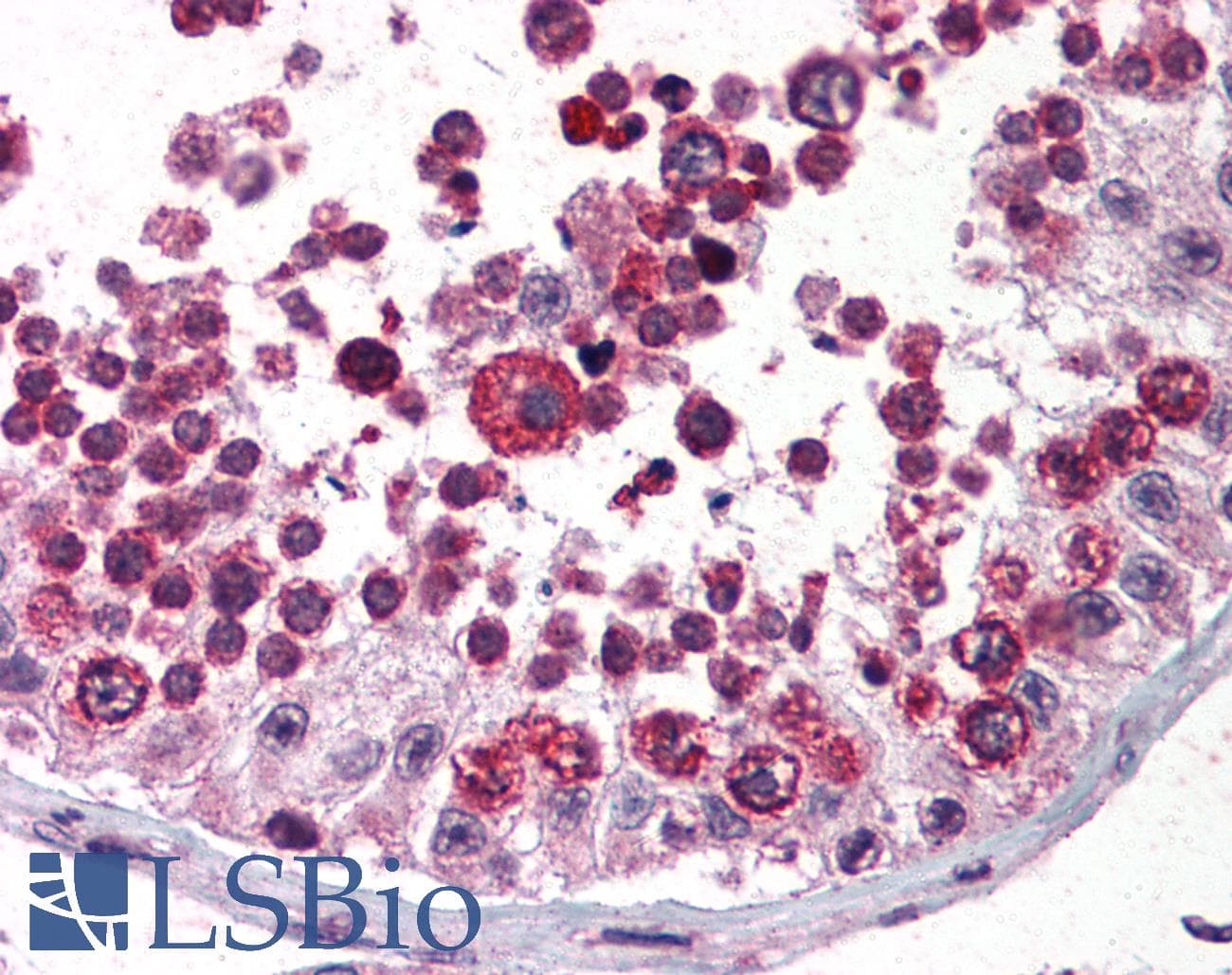 IHC-plus™ AATF Antibody