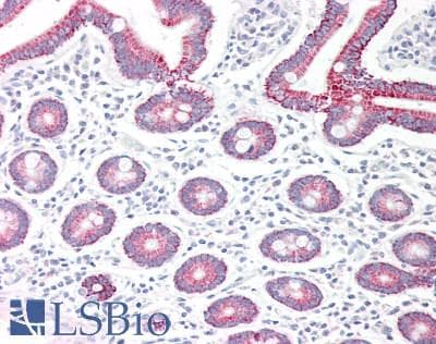 IHC-plus™ Polyclonal Goat anti-Human MAOA / Monoamine Oxidase Antibody (aa141-154, IHC, WB)
