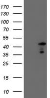 SERPINA5 / PCI Antibody (clone OTI2D10)