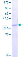 Human RETN / Resistin Protein (Recombinant GST)