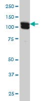 NCAPG / HCAP-G Antibody (clone 4B1)