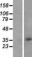 C11orf72 Protein (Over-Expression Lysate Myc-DDK (Flag))