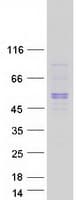 Human SBK1 Protein (Recombinant Myc-DDK (Flag))