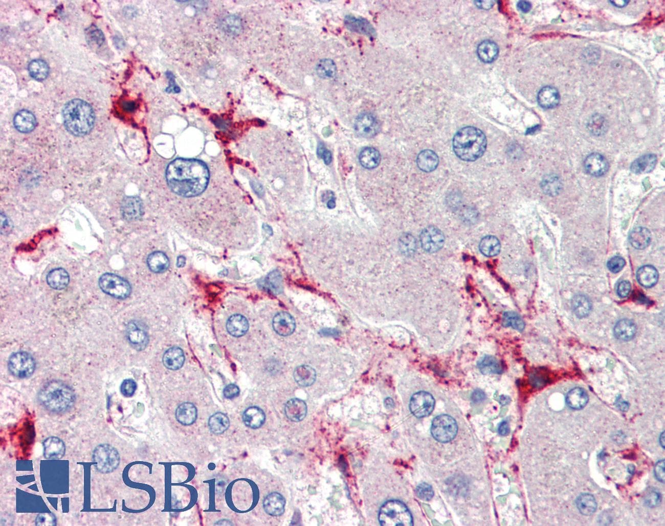 TSKS Antibody (N-Terminus)
