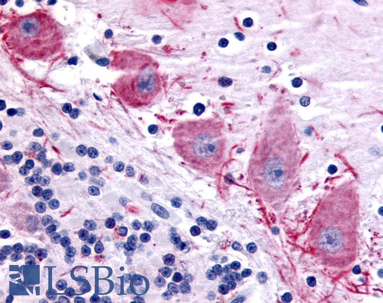 IHC-plus™ Dipeptidylpeptidase 10 / DPP10 Antibody (Extracellular Domain)