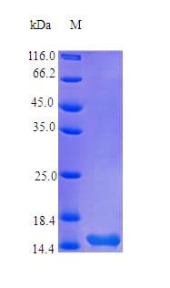 Human TSLP Protein (Recombinant)