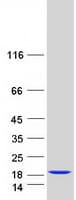 Human FABP3 / H-FABP Protein (Recombinant Myc-DDK (Flag))