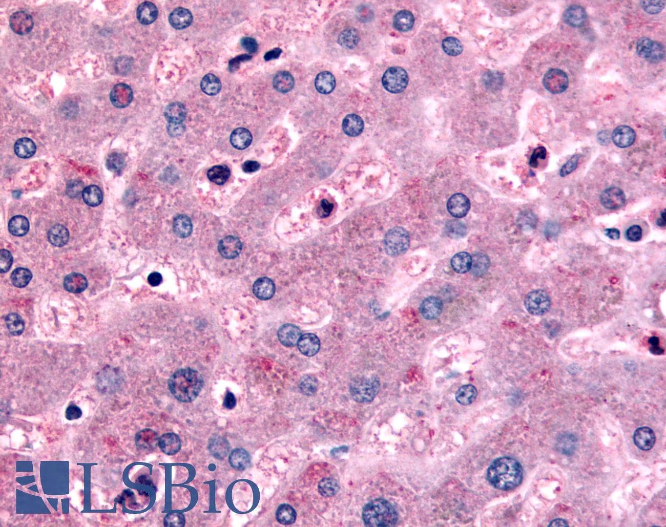 IHC-plus™ Polyclonal Rabbit anti-Human DPP9 Antibody (Internal, IHC)