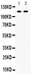 Polyclonal Rabbit anti-Human CD44 Antibody (aa29-56, IHC, WB)