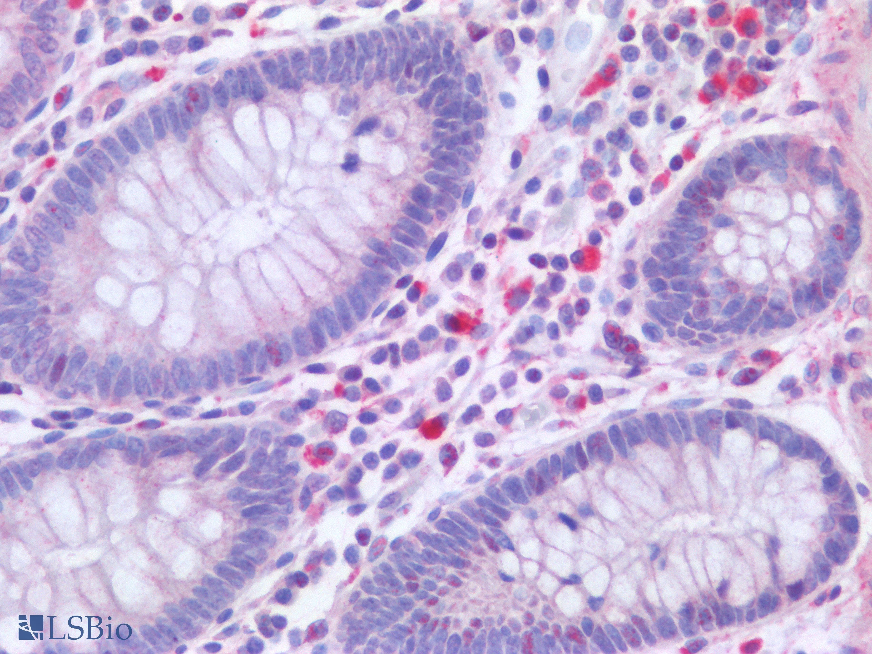 IHC-plus™ Polyclonal Rabbit anti-Human CD300A Antibody (IHC)