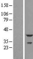 TNNT2 / CTNT Protein (Over-Expression Lysate Myc-DDK (Flag))
