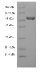 Mouse HAS2 Protein (Recombinant 6His-SUMO, N-terminus)