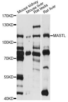 Polyclonal Rabbit anti-Human MASTL / GW Antibody (WB)