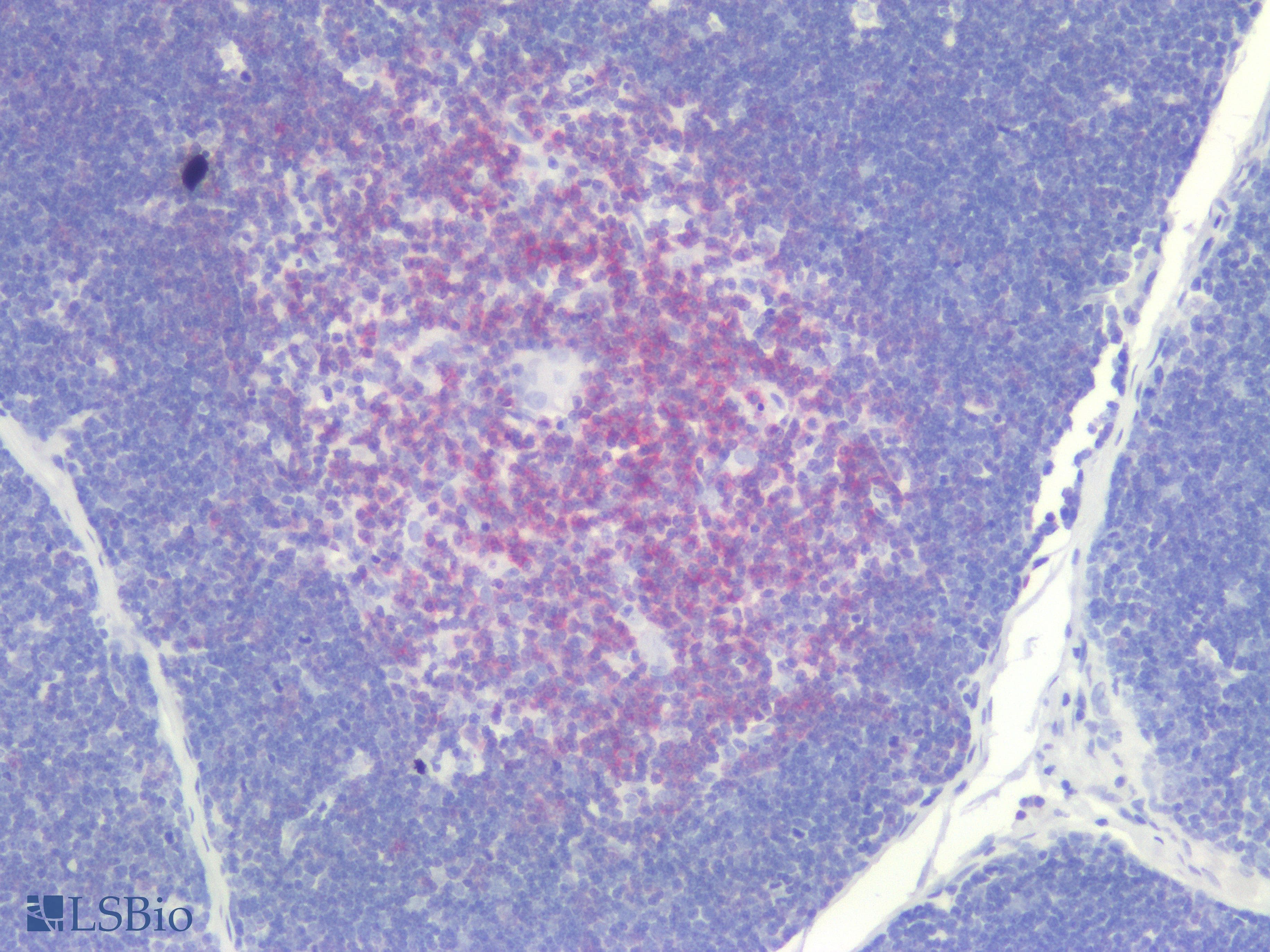 IHC-plus™ Monoclonal Mouse anti-Human CD5 Antibody (clone L17F12, IHC, WB)
