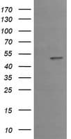 Monoclonal Mouse anti-Human EGR2 Antibody (clone OTI1B12, IHC, IF, WB)