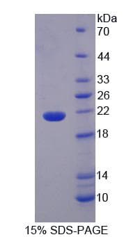 Human IL1F9 Protein (Recombinant His-T7)