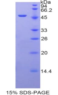 Human ARRB2 / Beta Arrestin 2 Protein (Recombinant His-GST)