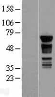Human PAK4 Protein (Over-Expression Lysate Myc-DDK (Flag))