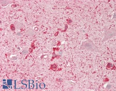 IHC-plus™ ADAM9 Antibody (aa400-450)
