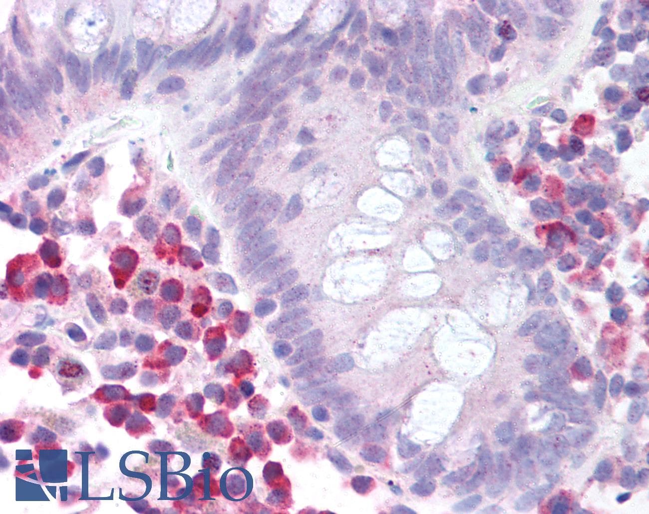 IHC-plus™ MTOR Antibody