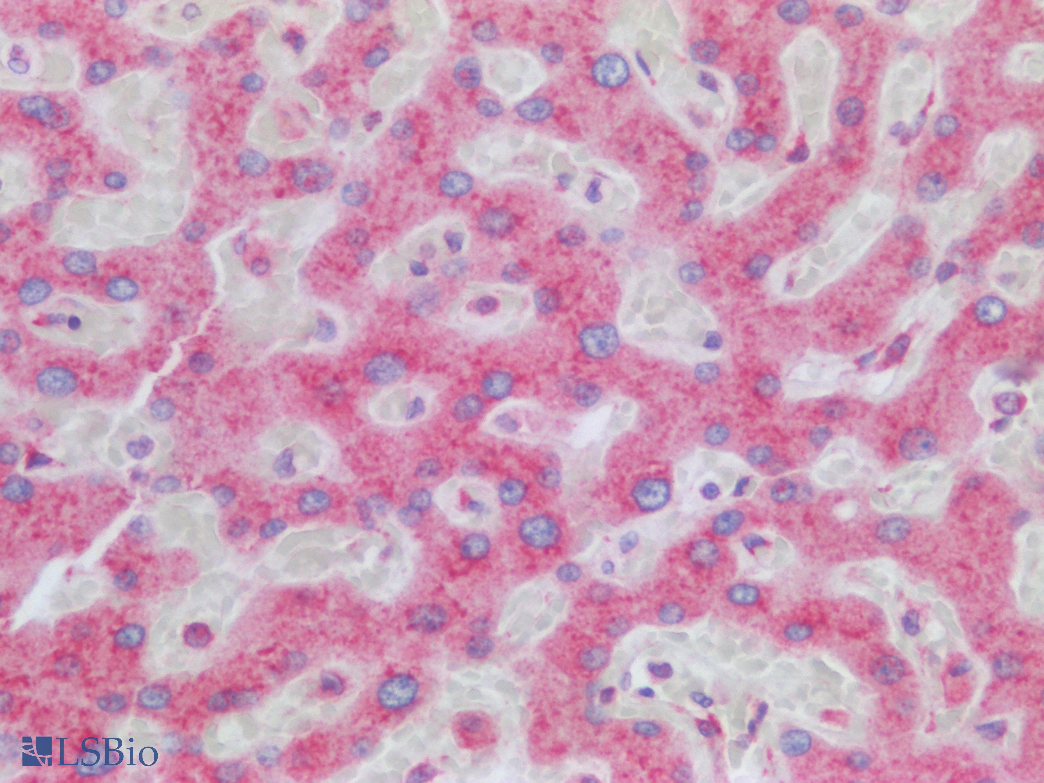 PathPlus™ MTDH / Metadherin Antibody (aa70-582, clone OTI1E7)