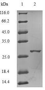 Human ESR2 / ER Beta Protein (Recombinant 6His-SUMO, N-terminus)