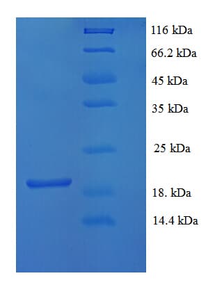 Mouse FGF1 / Acidic FGF Protein (Recombinant His)
