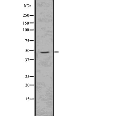 Polyclonal Rabbit anti-Human DCX / Doublecortin Antibody (phospho-Ser334, IHC, WB)