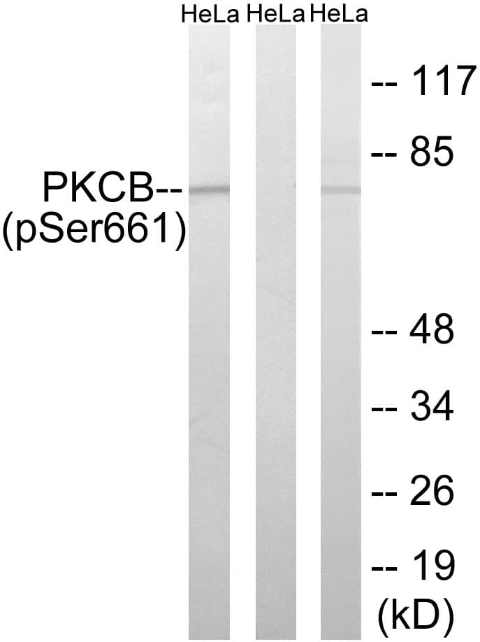 PRKCB / PKC-Beta Antibody (phospho-Ser661)