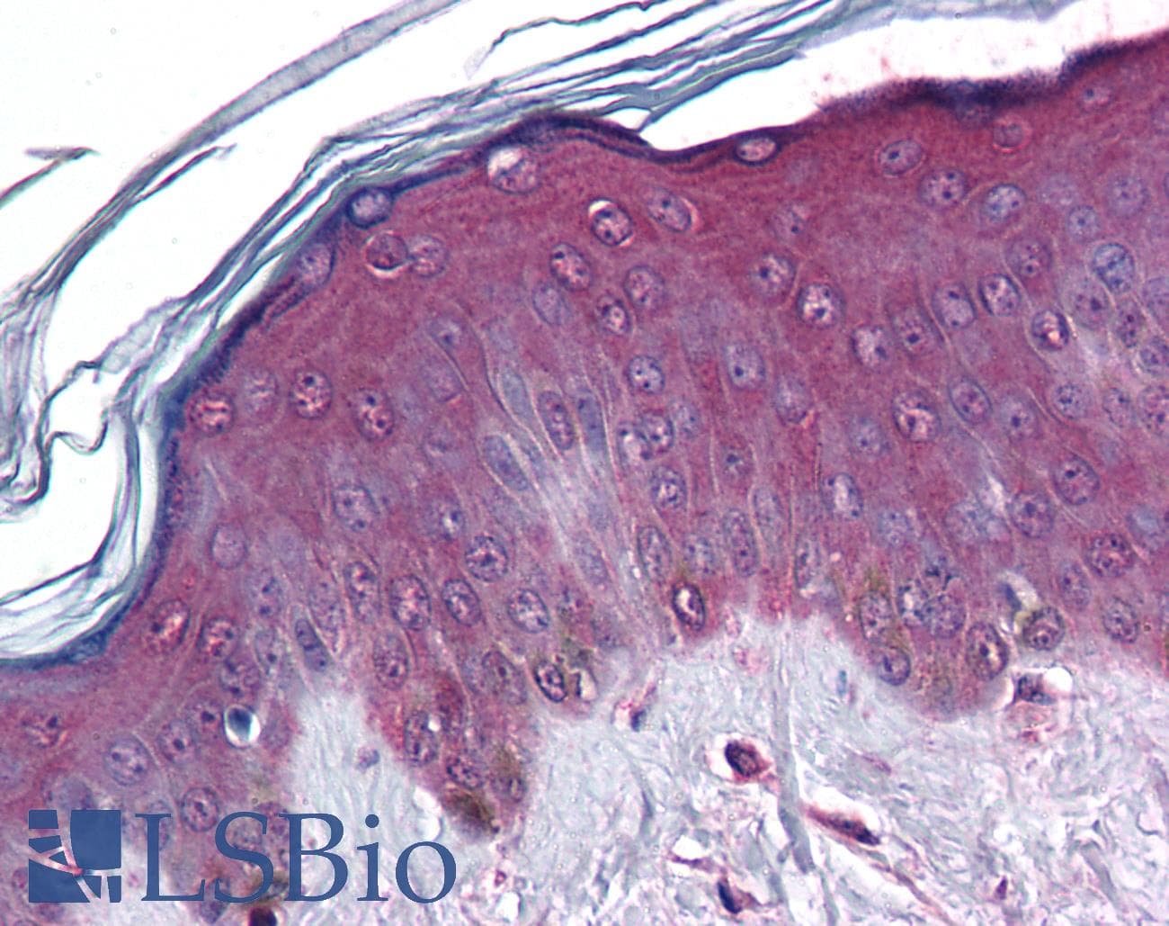 IHC-plus™ Monoclonal Mouse anti-Human CORO1C Antibody (clone 1F7, IHC, WB)