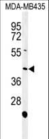 NOXA1 Antibody (aa449-478)