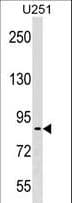 Polyclonal Rabbit anti-Human PES1 Antibody (aa549-578, WB)