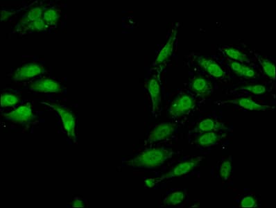 Polyclonal Rabbit anti-Human HIST1H3A Antibody (IF)