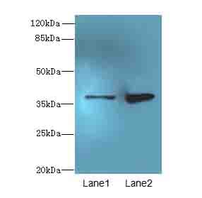 Polyclonal Rabbit anti-Human CLYBL Antibody (IHC, WB)