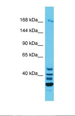 Polyclonal Rabbit anti-Human QSER1 Antibody (aa1358-1407, WB)