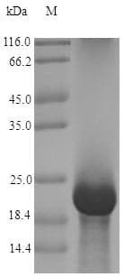 Aspergillus giganteus AFP Protein (Recombinant 6His-B2M, N-terminus)