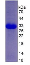 Human EIF2AK2 / PKR Protein (Recombinant 6His, N-terminus)