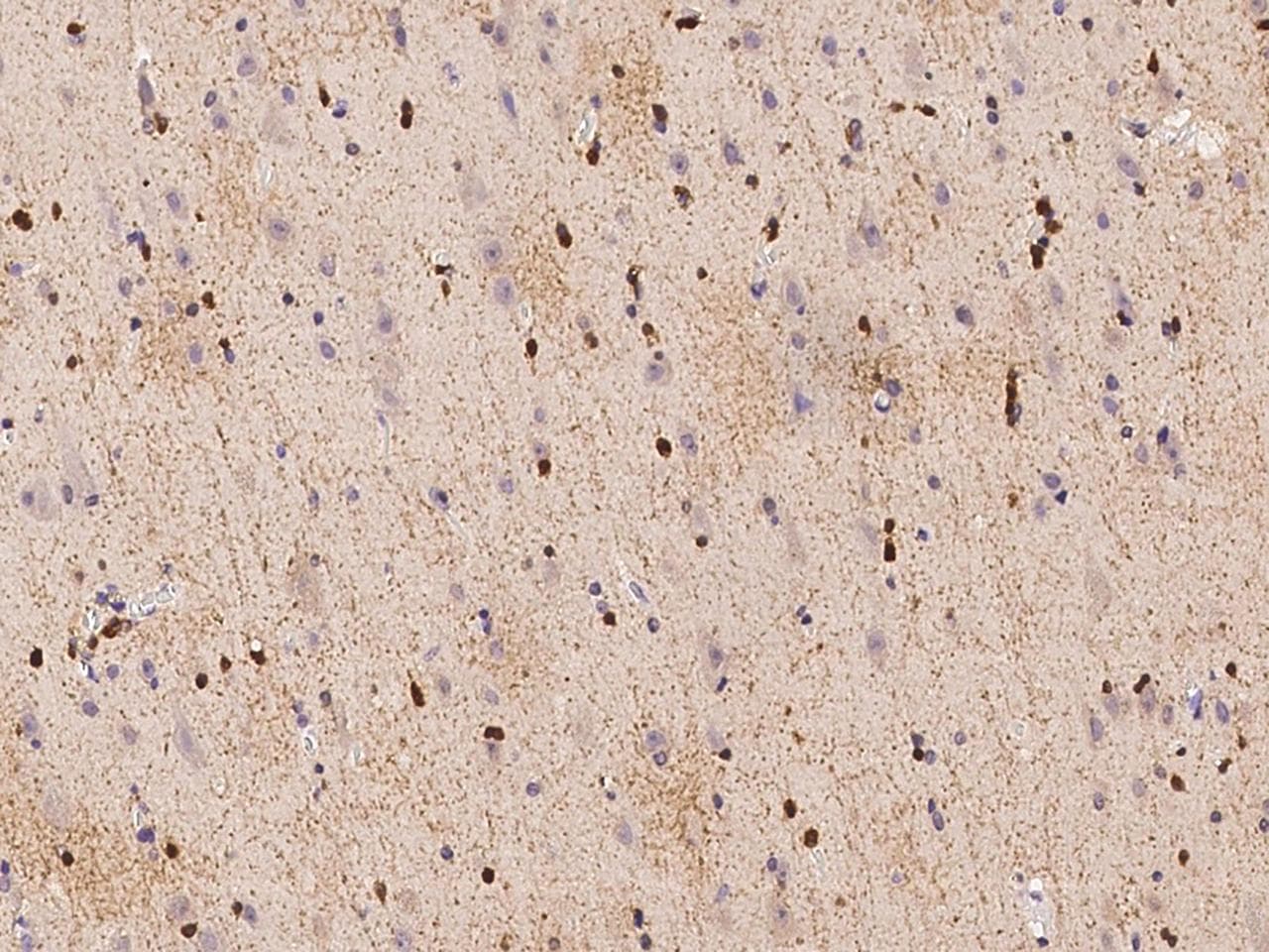 ASPA Antibody