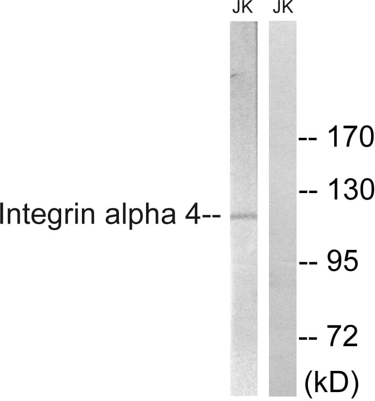 ITGA4 / VLA-4 / CD49d Antibody (aa983-1032)