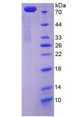 Human ATP2A2 / SERCA2 Protein (Recombinant His-GST)