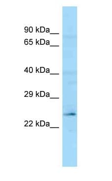 Polyclonal Rabbit anti-Human FGF19 Antibody (C-Terminus, WB)