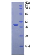 Mouse IGF2R / CD222 Protein (Recombinant His, N-Terminal)