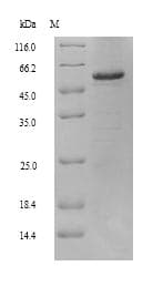 Human RALDH2 / ALDH1A2 Protein (Recombinant 6His, N-terminus)