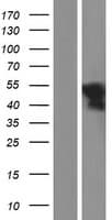 Human WT1 / Wilms Tumor 1 Protein (Over-Expression Lysate Myc-DDK (Flag))